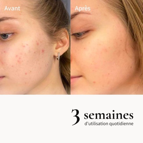 Huile métamorphose démaquillante 100% d'origine naturelle