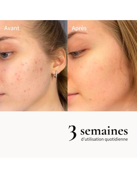 Huile métamorphose démaquillante 100% d'origine naturelle