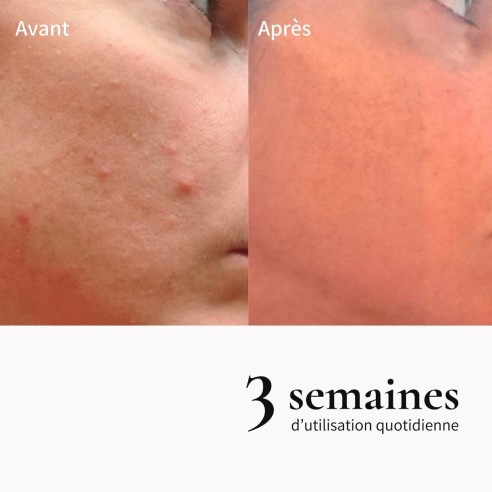 Crème de mousse exfoliante sublimatrice