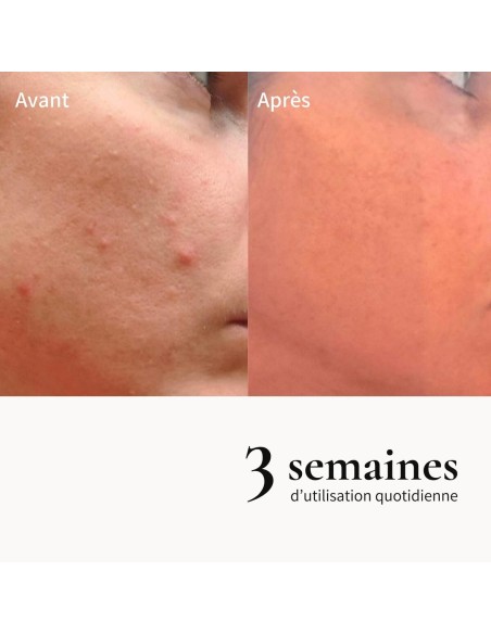 Crème de mousse exfoliante sublimatrice