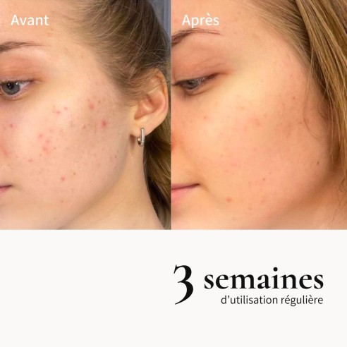 Pack Huile métamorphose démaquillante réconfortante